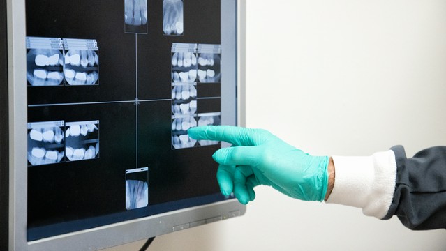 Zdjęcia rentgenowskie